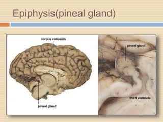 Epiphysis(pineal gland)
 