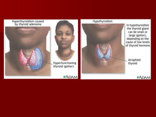 endocrine.ppt