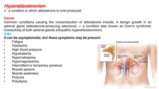 Endocrine DIseases Slide 33