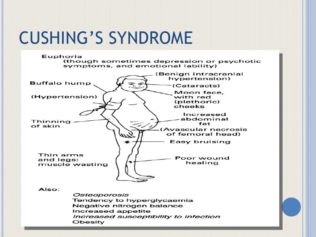 Endocrine Disorders