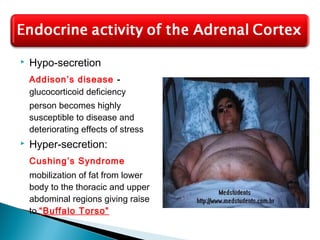  Hypo-secretion
Addison’s disease -
glucocorticoid deficiency
person becomes highly
susceptible to disease and
deteriorating effects of stress
 Hyper-secretion:
Cushing’s Syndrome
mobilization of fat from lower
body to the thoracic and upper
abdominal regions giving raise
to “Buffalo Torso”
 