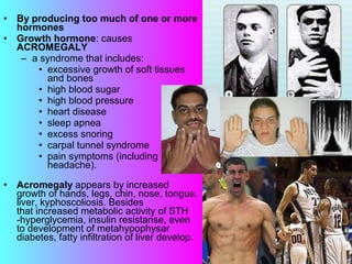 • By producing too much of one or more
hormones
• Growth hormone: causes
ACROMEGALY
– a syndrome that includes:
• excessive growth of soft tissues
and bones
• high blood sugar
• high blood pressure
• heart disease
• sleep apnea
• excess snoring
• carpal tunnel syndrome
• pain symptoms (including
headache).
• Acromegaly appears by increased
growth of hands, legs, chin, nose, tongue,
liver, kyphoscoliosis. Besides
that increased metabolic activity of STH
-hyperglycemia, insulin resistanse, even
to development of metahypophysar
diabetes, fatty infiltration of liver develop.
 