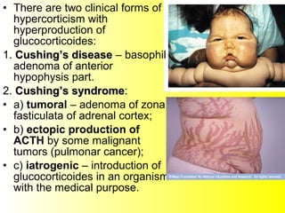 • There are two clinical forms of
hypercorticism with
hyperproduction of
glucocorticoides:
1. Cushing’s diseaseCushing’s disease – basophil
adenoma of anterior
hypophysis part.
2. Cushing’s syndromeCushing’s syndrome:
• а) tumoral – adenoma of zona
fasticulata of adrenal cortex;
• b) ectopic production of
АCТH by some malignant
tumors (pulmonar cancer);
• c) iatrogenic – introduction of
glucocorticoides in an organism
with the medical purpose.
 