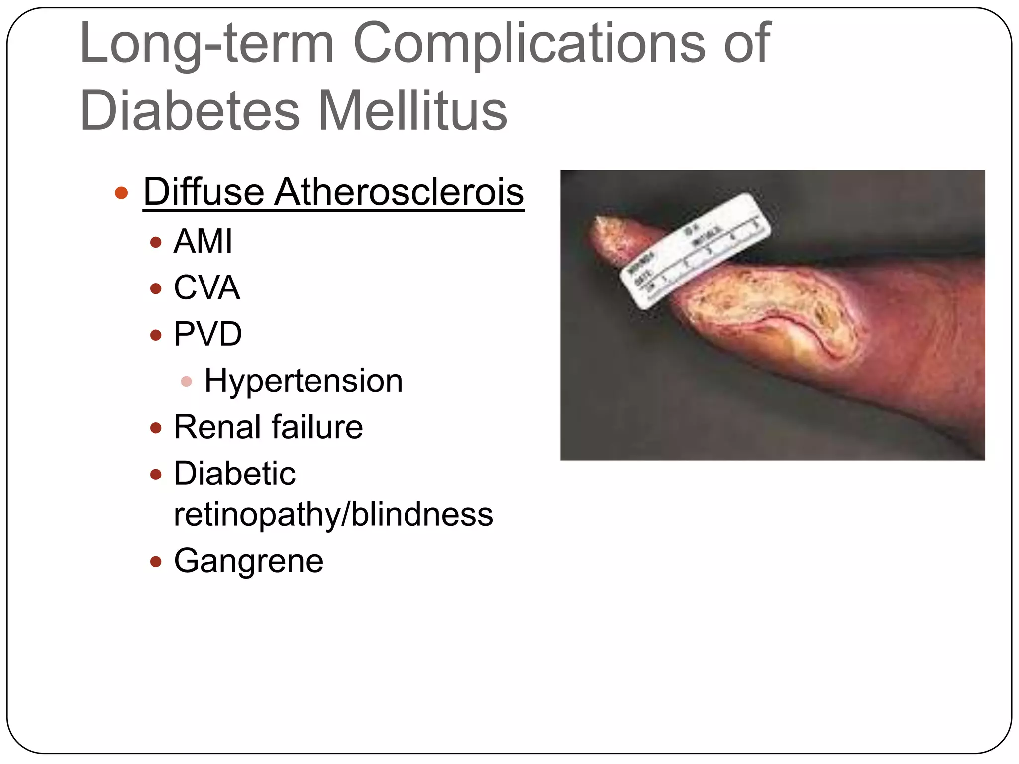 Gestational Diabetes MellitusOccurs during pregnancyUsually resolves after deliveryOccurs rarely in non-pregnant women on BCPsIncreased estrogen, progesterone antagonize insulin
