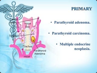 • Parathyroid adenoma.
• Parathyroid carcinoma.

• Multiple endocrine
neoplasia.

 