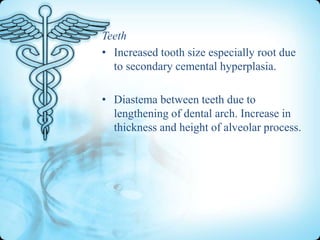 Teeth
• Increased tooth size especially root due
to secondary cemental hyperplasia.
• Diastema between teeth due to
lengthening of dental arch. Increase in
thickness and height of alveolar process.

 