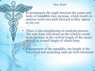 Jaw bone
• In acromegaly the angle between the ramus and
body of mandible may increase, which results in
anterior tooth root push forward so they appear
as fan out.
• There is also lengthening of condylar process,
The new bone laid down on the condyle results
in an increase in the vertical length of the ramus
as well as overall length of whole bone.
• Enlargement of the mandible, the length of the
horizontal and ascending rami are both increased.

 