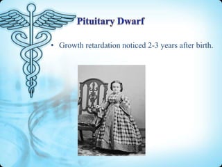• Growth retardation noticed 2-3 years after birth.

 