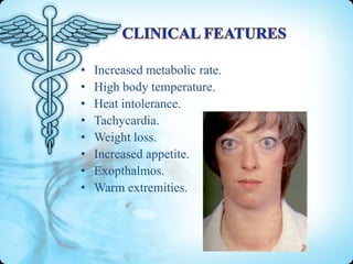 •
•
•
•
•
•
•
•

Increased metabolic rate.
High body temperature.
Heat intolerance.
Tachycardia.
Weight loss.
Increased appetite.
Exopthalmos.
Warm extremities.

 
