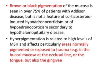 • Brown or black pigmentation of the mucosa is
seen in over 75% of patients with Addison
disease, but is not a feature of corticosteroid-
induced hypoadrenocorticism or of
hypoadrenocorticism secondary to
hypothalamopituitary disease.
• Hyperpigmentation is related to high levels of
MSH and affects particularly areas normally
pigmented or exposed to trauma (e.g. in the
buccal mucosa at the occlusal line, or the
tongue, but also the gingivae
 