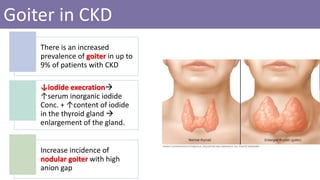 Goiter in CKD
There is an increased
prevalence of goiter in up to
9% of patients with CKD
↓iodide execration
↑serum inorganic iodide
Conc. + ↑content of iodide
in the thyroid gland 
enlargement of the gland.
Increase incidence of
nodular goiter with high
anion gap
 