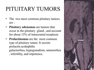 PITUITARY TUMORS
• The two most common pituitary tumors
  are :
• Pituitary adenomas are tumors that
  occur in the pituitary gland , and account
  for about 15% of intracranial neoplasm
• Prolactinomas are the most common
  type of pituitary tumor. It secrete
  prolactin acidophilic
  galactorrhea, hypogonadism, amenorrhea
  , infertility, and impotence.
 