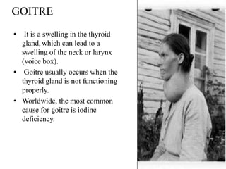 GOITRE
•  It is a swelling in the thyroid
  gland, which can lead to a
  swelling of the neck or larynx
  (voice box).
• Goitre usually occurs when the
  thyroid gland is not functioning
  properly.
• Worldwide, the most common
  cause for goitre is iodine
  deficiency.
 