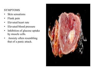 SYMPTOMS
• Skin sensations
• Flank pain
• Elevated heart rate
• Elevated blood pressure
• Inhibition of glucose uptake
  by muscle cells.
• Anxiety often resembling
  that of a panic attack.
 