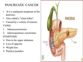 PANCREATIC CANCER

•  It is a malignant neoplasm of the
   pancreas.
• Also called a "silent killer―.
• Caused by a variety of reasons.
TYPES
1. Adenocacarcinoma
2. Adenosquamous carcinomas
SYMPTOMS
 Pain in the upper abdomen
 Loss of appetite
 Weight loss
 Painless jaundice
 