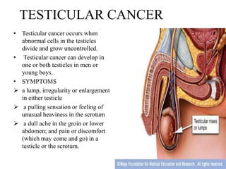 TESTICULAR CANCER
• Testicular cancer occurs when
  abnormal cells in the testicles
  divide and grow uncontrolled.
• Testicular cancer can develop in
  one or both testicles in men or
  young boys.
• SYMPTOMS
 a lump, irregularity or enlargement
  in either testicle
 a pulling sensation or feeling of
  unusual heaviness in the scrotum
 a dull ache in the groin or lower
  abdomen; and pain or discomfort
  (which may come and go) in a
  testicle or the scrotum.
 