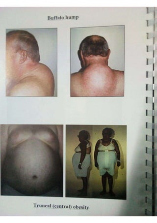 Endocrine dr hawary 2021