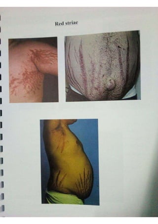 Endocrine dr hawary 2021