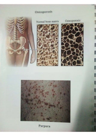 Endocrine dr hawary 2021