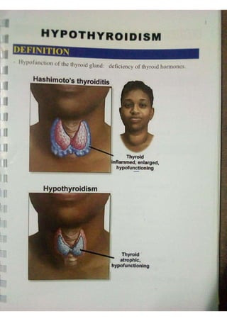 Endocrine dr hawary 2021