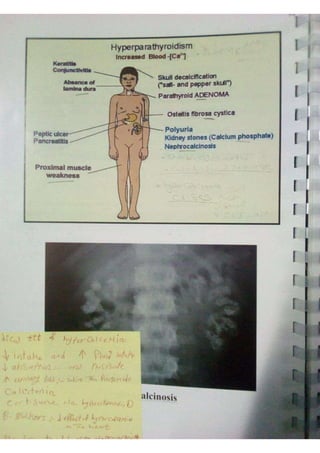 Endocrine dr hawary 2021