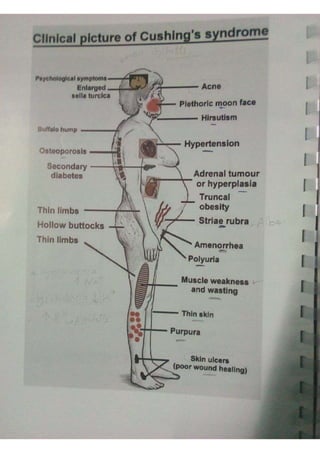 Endocrine dr hawary 2021