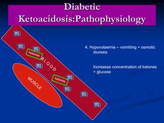 Diabetic
Ketoacidosis:Pathophysiology
4. Hypovolaemia – vomitting + osmotic
diuresis
Increases concentration of ketones
+ glucose
 