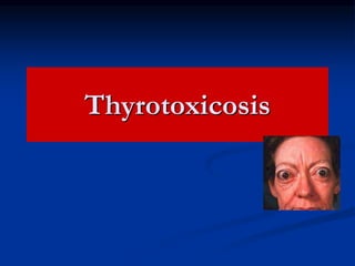 Thyrotoxicosis
 