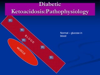 Diabetic
Ketoacidosis:Pathophysiology
Normal – glucose in
blood
 