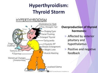 Hyperthyroidism:
Thyroid Storm
Overproduction of thyroid
hormones:
 Affected by anterior
pituitary and
hypothalamus
 Positive and negative
feedback
 