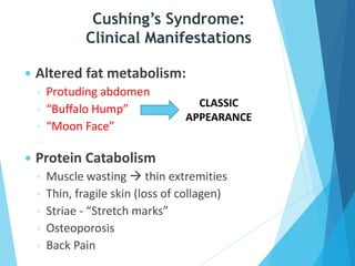 Cushing’s Syndrome:
Clinical Manifestations
 Altered fat metabolism:
◦ Protuding abdomen
◦ “Buffalo Hump”
◦ “Moon Face”
◦
 Protein Catabolism
◦ Muscle wasting  thin extremities
◦ Thin, fragile skin (loss of collagen)
◦ Striae - “Stretch marks”
◦ Osteoporosis
◦ Back Pain
CLASSIC
APPEARANCE
 