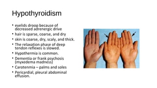 Hypothyroidism
• eyelids droop because of
decreased adrenergic drive
• hair is sparse, coarse, and dry
• skin is coarse, dry, scaly, and thick.
• The relaxation phase of deep
tendon reflexes is slowed.
• Hypothermia is common.
• Dementia or frank psychosis
(myxedema madness)
• Carotenmia – palms and soles
• Pericardial, pleural abdominal
effusion.
 