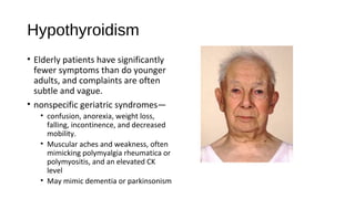 Hypothyroidism
• Elderly patients have significantly
fewer symptoms than do younger
adults, and complaints are often
subtle and vague.
• nonspecific geriatric syndromes—
• confusion, anorexia, weight loss,
falling, incontinence, and decreased
mobility.
• Muscular aches and weakness, often
mimicking polymyalgia rheumatica or
polymyositis, and an elevated CK
level
• May mimic dementia or parkinsonism
 
