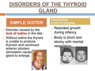 DISORDERS OF THE THYROID
GLAND
 Disorder caused by the
lack of Iodine in the diet.
 Without iodine the thyroid
is unable to produce
thyroxin and continued
anterior pituitary
stimulation causes the
gland to enlarge.
 Retarded growth
during infancy.
 Body is short and
stocky with mental
retardation
SIMPLE GOITER
CONGENITAL
HYPOTHYROIDISM
 