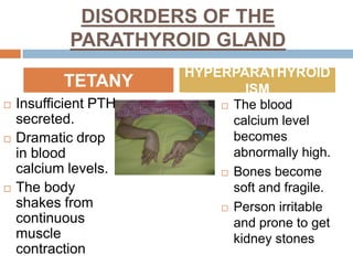 DISORDERS OF THE
PARATHYROID GLAND
 Insufficient PTH
secreted.
 Dramatic drop
in blood
calcium levels.
 The body
shakes from
continuous
muscle
contraction
 The blood
calcium level
becomes
abnormally high.
 Bones become
soft and fragile.
 Person irritable
and prone to get
kidney stones
TETANY
HYPERPARATHYROID
ISM
 