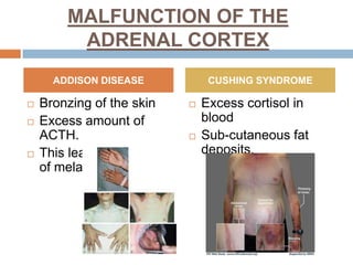 MALFUNCTION OF THE
ADRENAL CORTEX
 Bronzing of the skin
 Excess amount of
ACTH.
 This lead to a buildup
of melanin.
 Excess cortisol in
blood
 Sub-cutaneous fat
deposits.
ADDISON DISEASE CUSHING SYNDROME
 