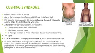 CUSHING SYNDROME
 disorder characterized by obesity.
 due to the hypersecretion of glucocorticoids, particularly cortisol
 If it is due to pituitary origin, it is known as Cushing disease. If it is due to
adrenal origin it is called Cushing syndrome.
 Adrenal Origin: Cortisol secretion is increased by:
 i. Tumor in zona fasciculata of adrenal cortex
 ii. Carcinoma of adrenal cortex
 iii. Prolonged treatment of chronic inflammatory diseases like rheumatoid arthritis
 Two types:
 i. ACTH-dependent Cushing syndrome which is due to hypersecretion of ACTH
 ii. ACTH-independent Cushing syndrome in which the secretion of ACTH is
normal. The syndrome develops due to abnormal membrane receptors for some
peptides like interleukin-1, gonadotropin-releasing hormone and gastric inhibitory
polypeptide in the cells of zona fasciculata.
 