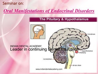Oral Manifestations of Endocrinal Disorders
Seminar on:
www.indiandentalacademy.com
INDIAN DENTAL ACADEMY
Leader in continuing Dental Education
 