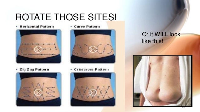 Endocrine metabolic nurs 3340