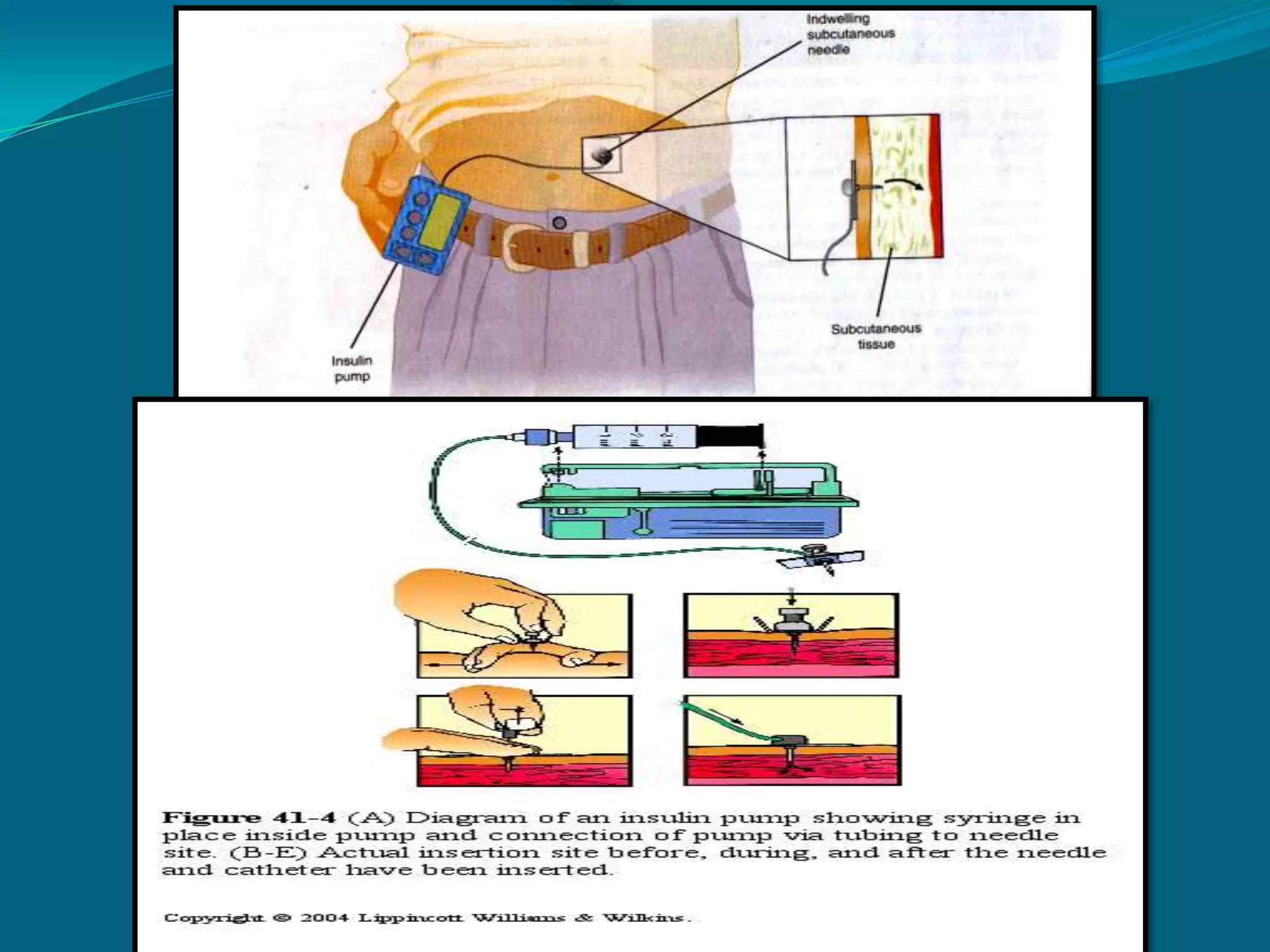 Necessary component for blood coagulation mechanismsPromotes absorption of calcium in the GI tract ( by stimulating kidneys to convert vit.D to its active form).HYPOCALCEMIA