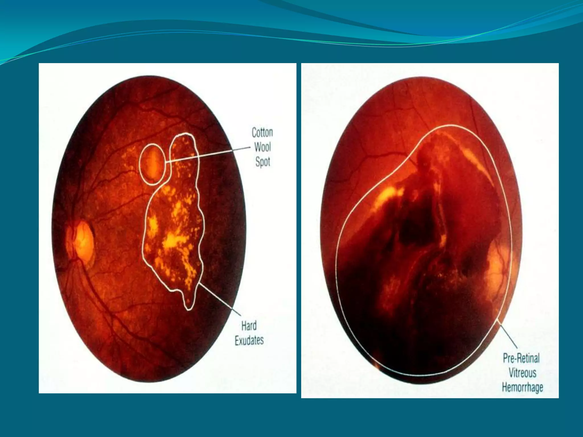  genetic / hereditary predisposition