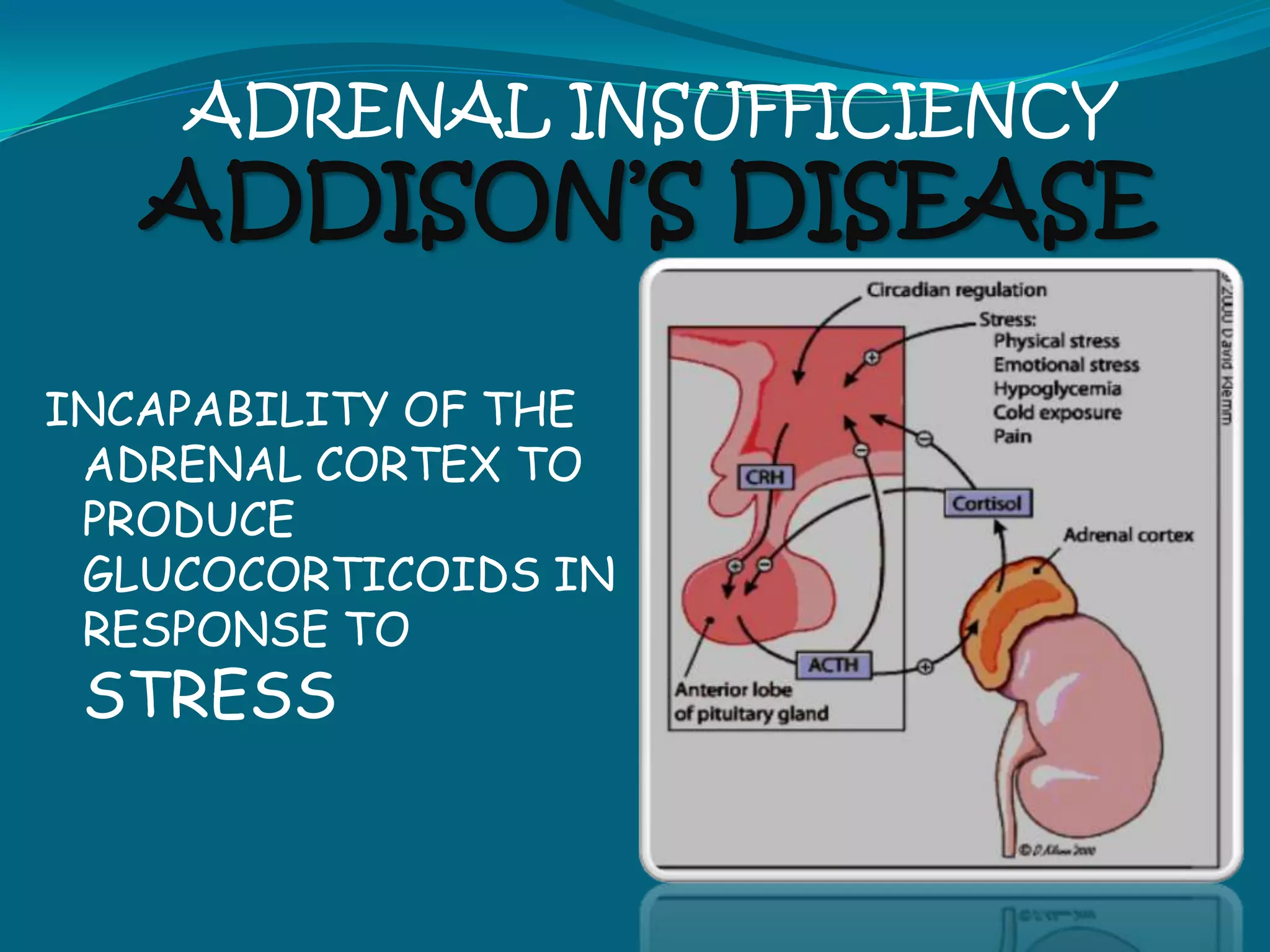  may occur at any age, usually appears below age 15Non Insulin–Dependent Diabetes Mellitus (NIDDM) or Type II probably caused by:
