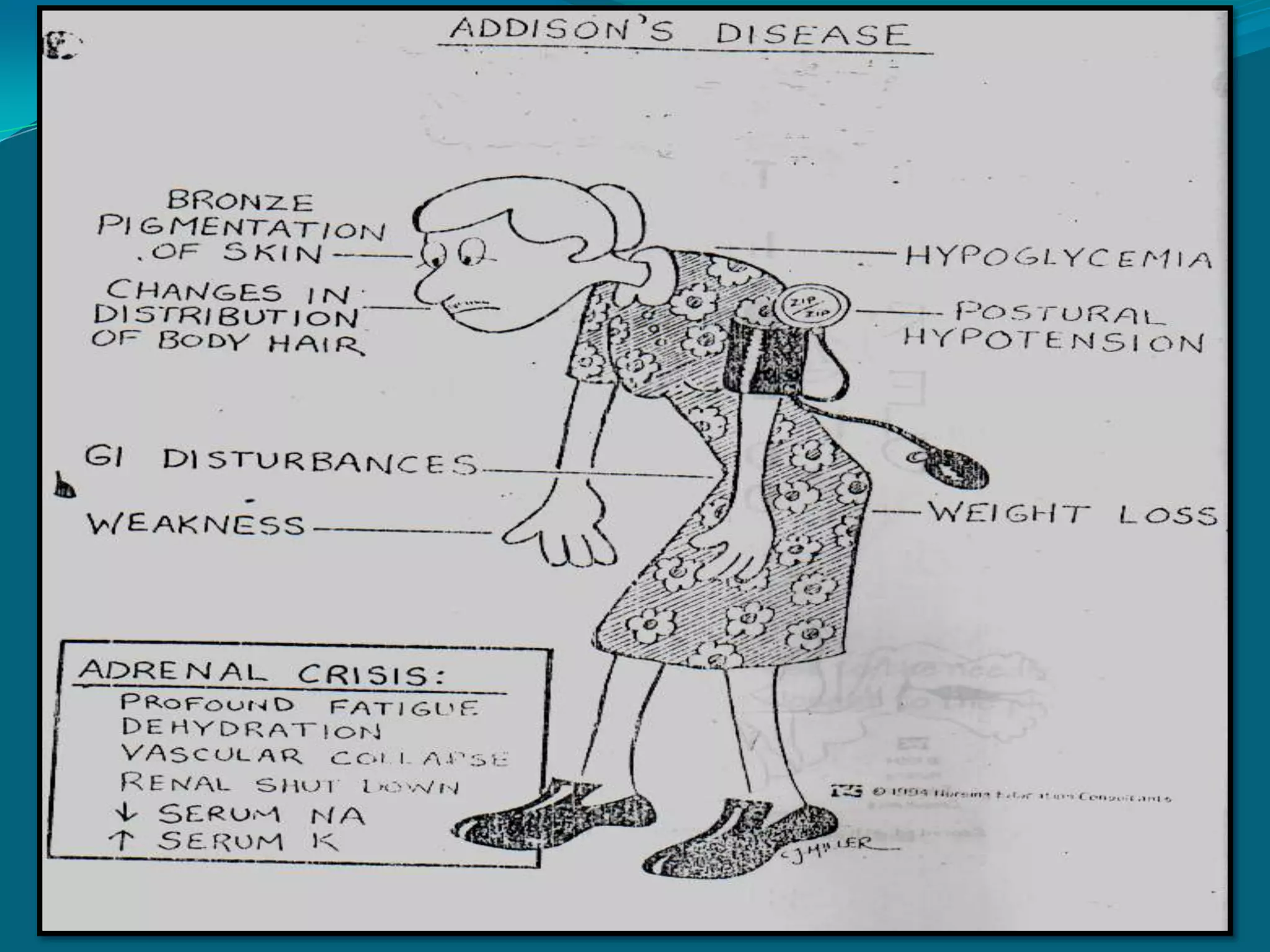  disturbance in insulin reception in the cells