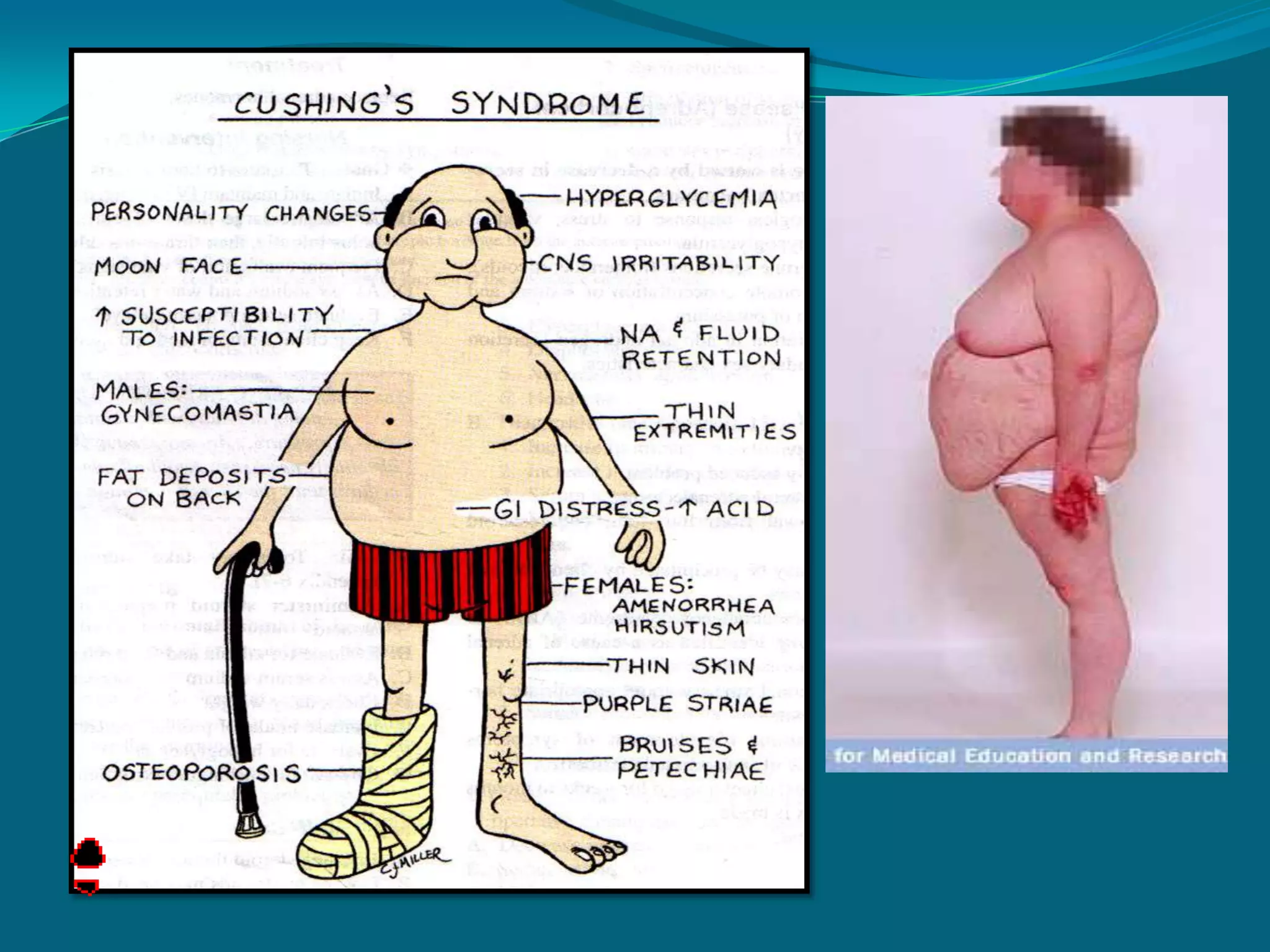 P olyuriaolydipsiaolyphagiaruritusaresthesiaoor healingoor eyesight