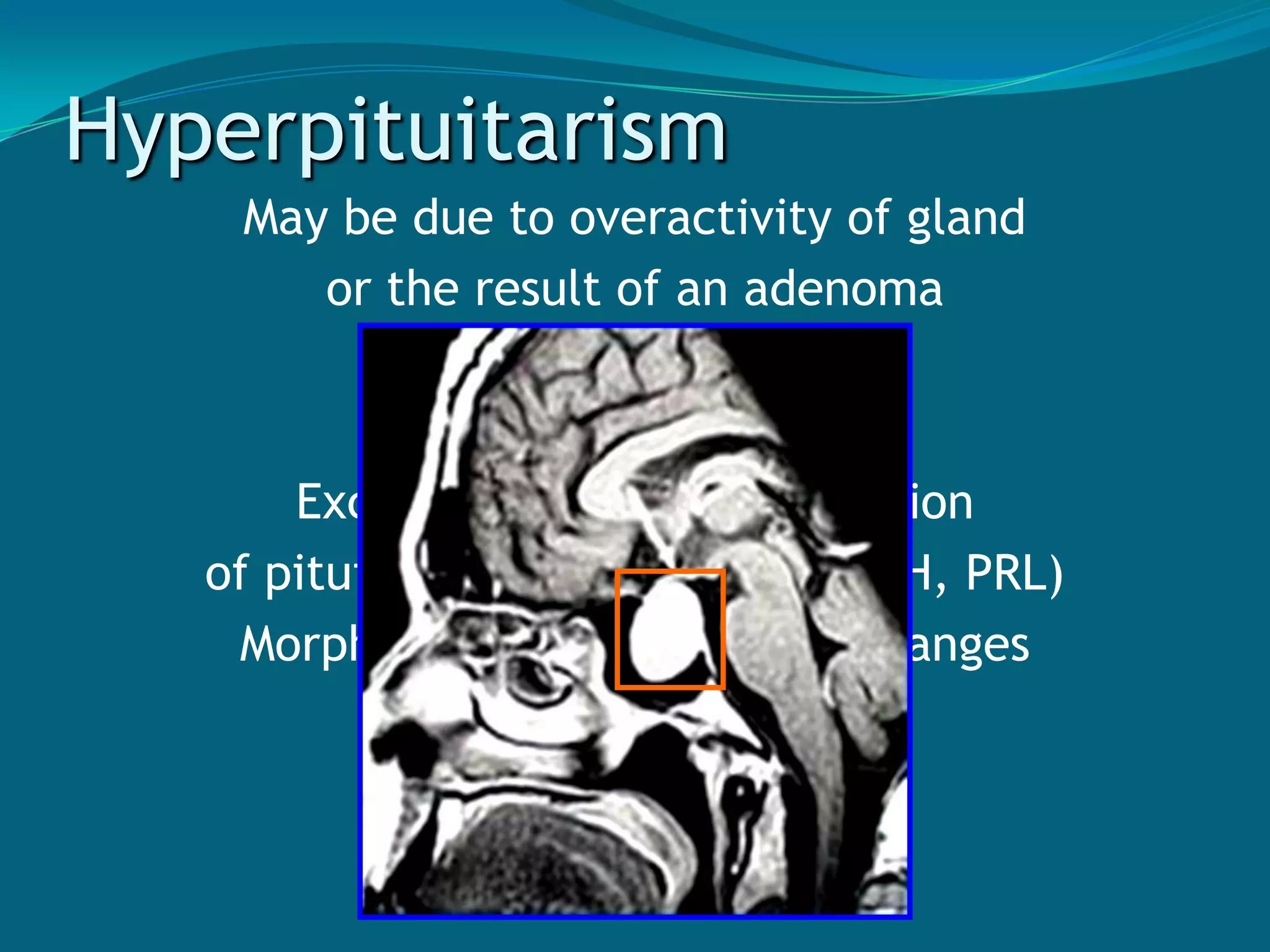 NEGATIVE FEEDBACK MECHANISMINCREASED HORMONE CONCENTRATION IN THE BLOOD(e.g.        Thyroxine)PITUITARY GLAND IS INHIBITED TORELEASE STIMULATING HORMONE (e.g.   TSH)DECREASED PRODUCTION & SECRETION OF TARGET ORGANOF THEHORMONE (e.g.     Thyroid gland release  of Thyroxine)RETURN OF THE NORMAL CONCENTRATION OF HORMONE