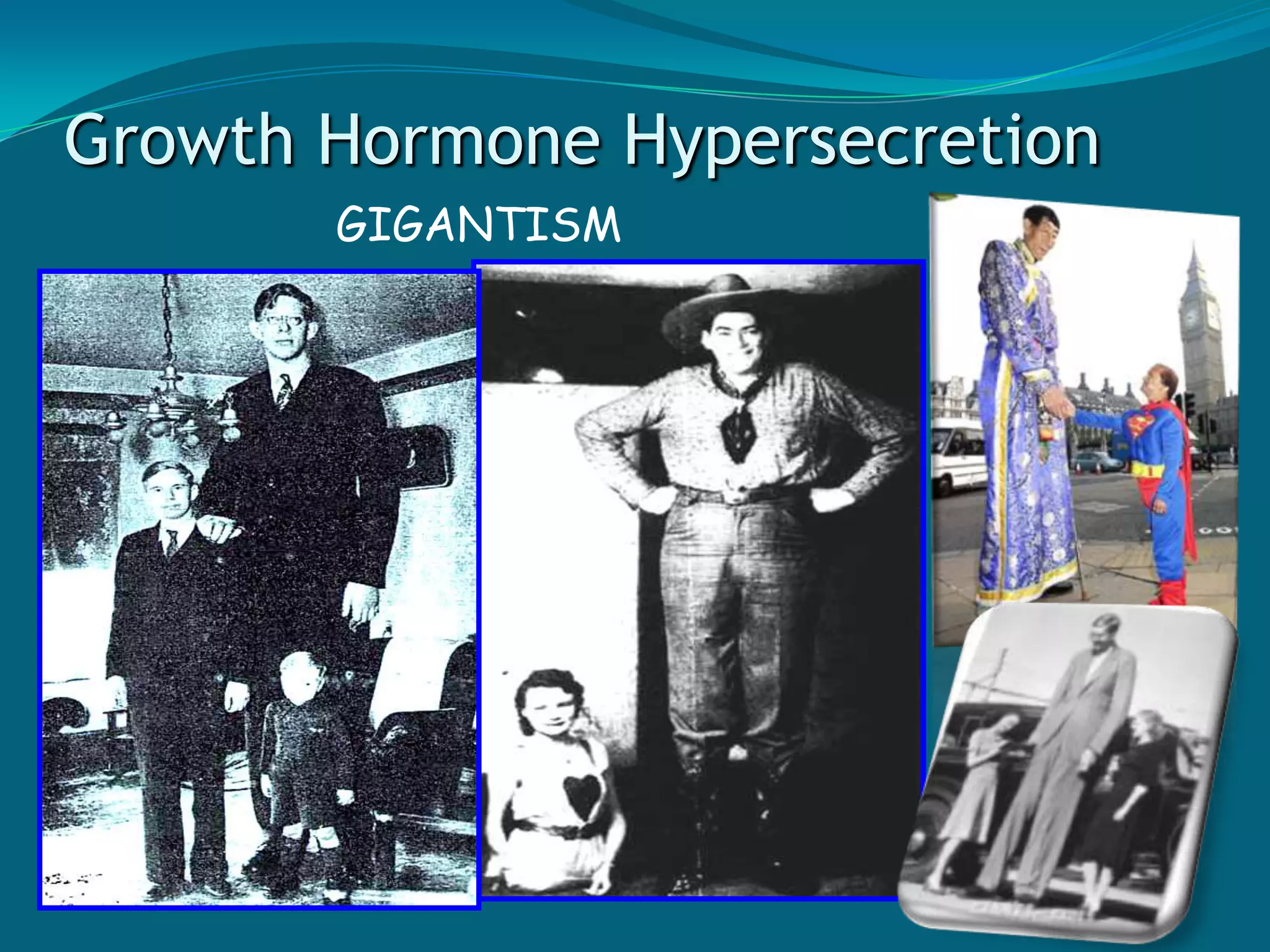 Endocrine DisordersIf you can remember what each hormone does in the body, it will be easier to remember what results from imbalances of that hormone. Most symptoms of hormone HYPERACTIVITY are the opposite of symptoms  of that hormones HYPOACTIVITY. 