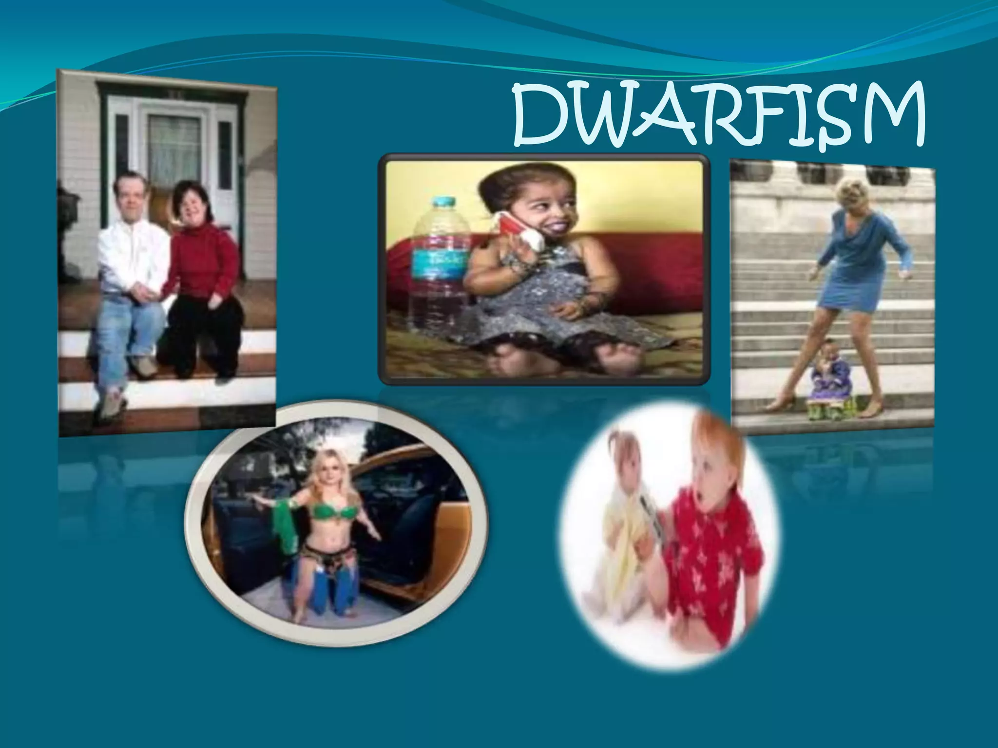 Hyperpituitarism:Clinical ManifestationsArthritisChest: barrel-shapedRough facial featuresOdd sensations: hands and feetMuscle weakness & fatigueEnlargement of organsGrowth of coarse hairAmenorrhea; breast milk productionLoss of vision; headachesImpotence; increased perspiration Snoring