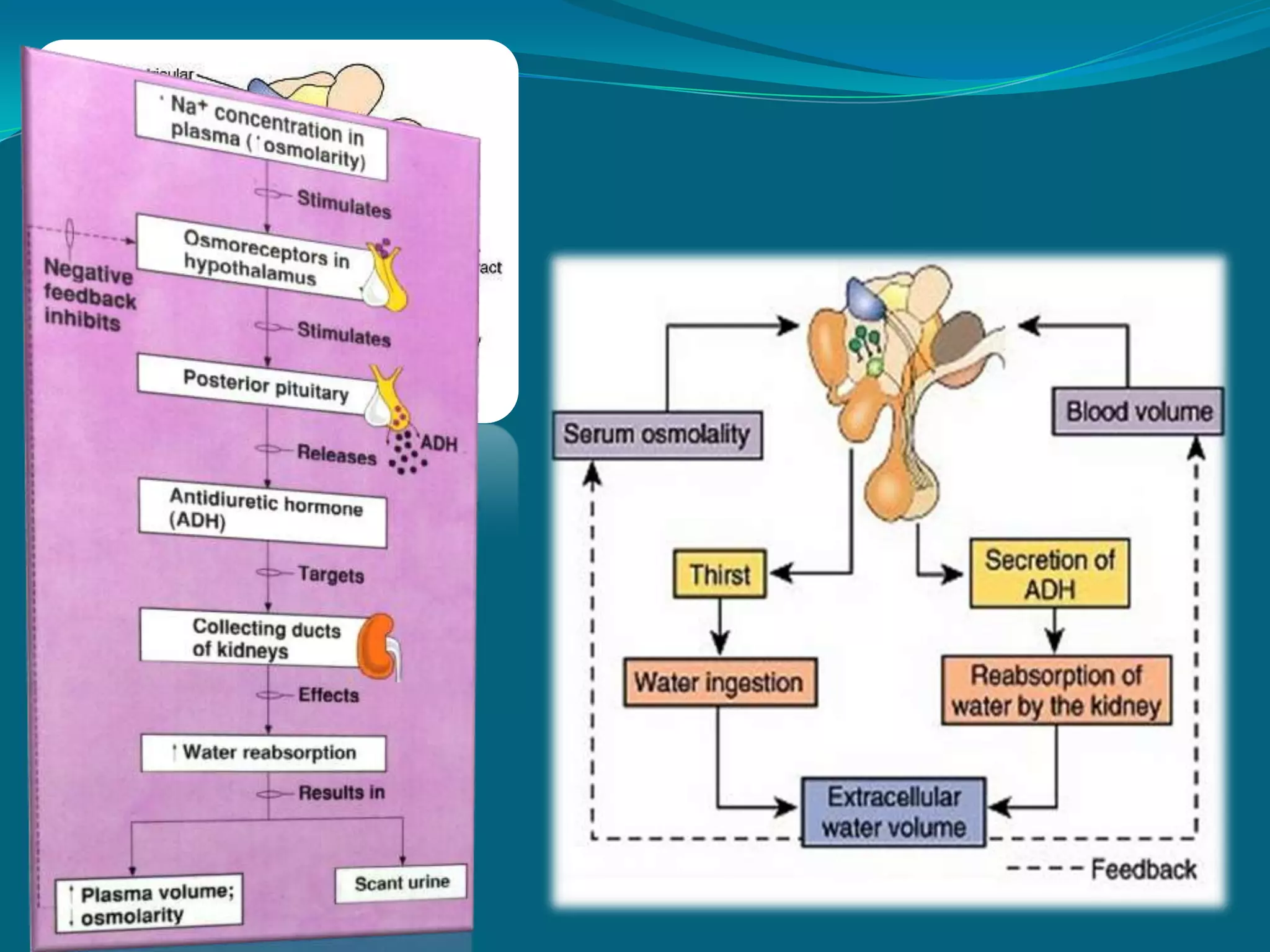 Trans-sphenoidal hypophysectomy