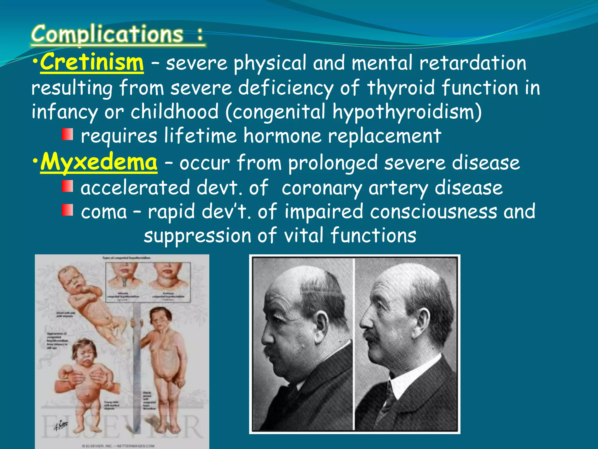 Hypothyroidism underactive state of the thyroid gland hyposecretion 		of thyroid hormone most common in women, middle-age primary function is to control the level of cellular 	metabolism 	by secreting thyroxin (T4) and 	triiodothyronine (T3)DX:  decreased T3, T4        Elevated TSH, cholesterol