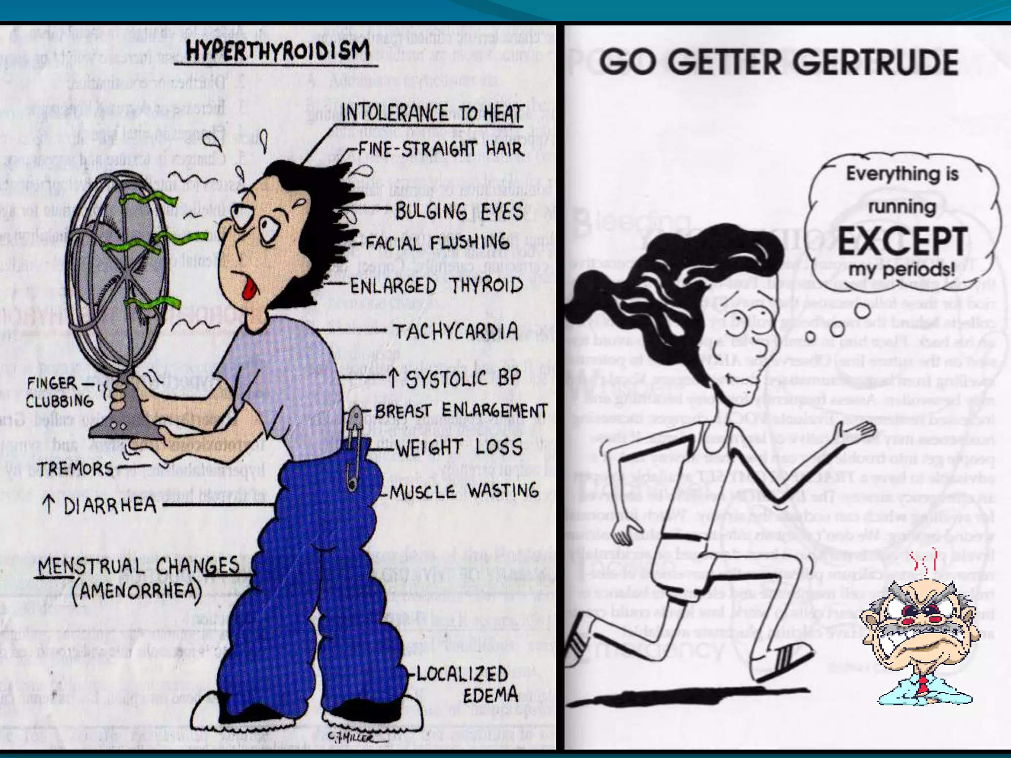 Med. Mgt. – thyroid replacement therapyLevothyroxine(Synthyroid) ,liothyronine Expected effects: diuresis, puffiness, improved reflexes and muscle tone, PR